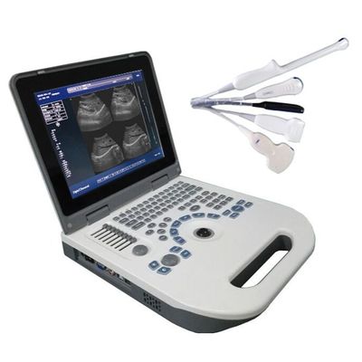 Ποιότητα  TGC Control Notebook Ultrasound Scanner For Pregnancy Home Use Εργοστάσιο