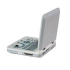 15 ιντσών LED Έγχρωμο Φορητό Μηχάνημα Υπερήχων με Γωνία Σάρωσης 60 μοιρών και ≥250mm Βάθος Εμφάνισης