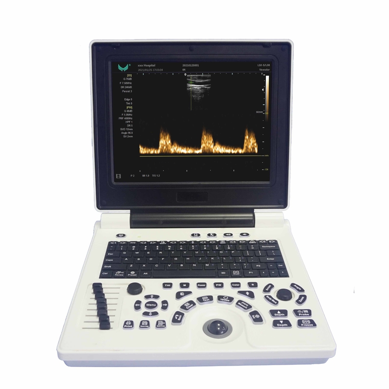 Φορητή μηχανή υπερήχου Doppler χρώματος OB GYN στην εγκυμοσύνη