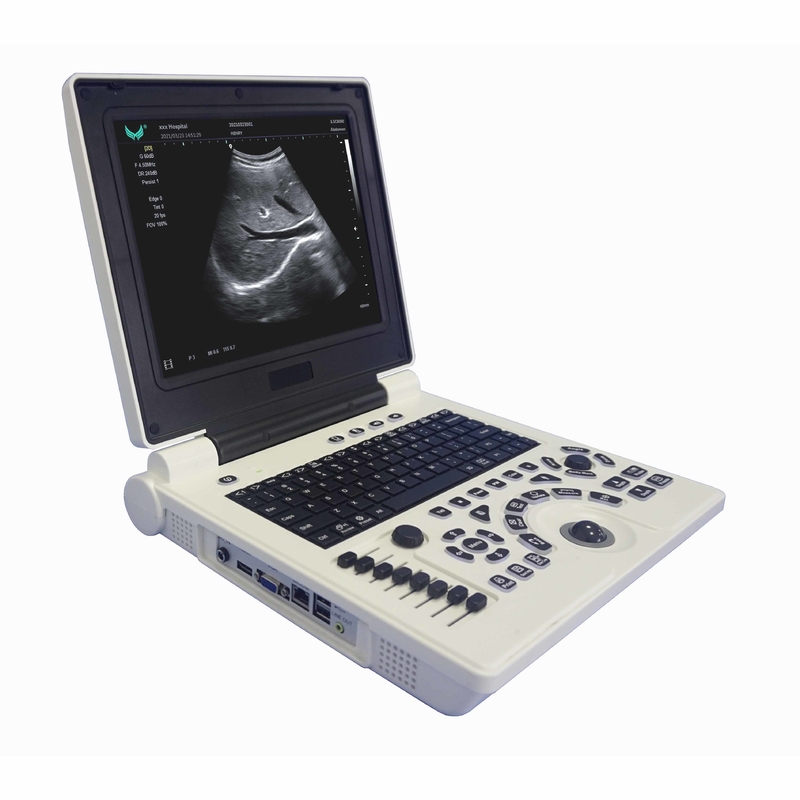 Φορητή μηχανή υπερήχου Doppler χρώματος OB GYN στην εγκυμοσύνη