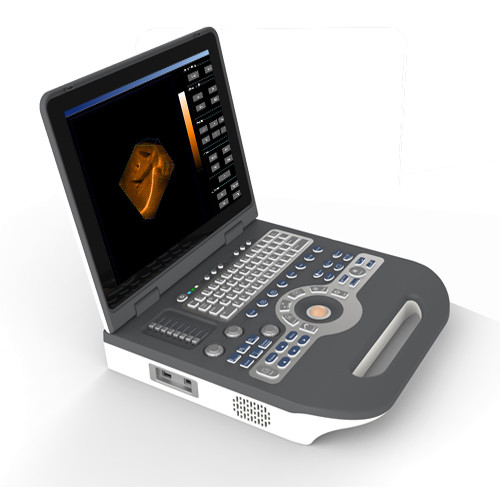 Eco ιατρική 4D χρώματος μηχανή Ultrasonography υπερήχου ψηφιακή φορητή