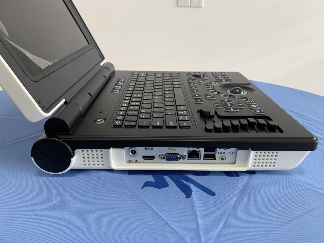 Win7 φορητή μπαταρία ανιχνευτών 3200mAh υπερήχου Doppler χρώματος συστημάτων