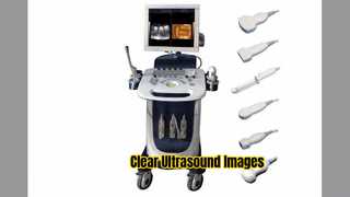 Σαρωτής υπερήχων Doppler PW CFM Λειτουργία PDI