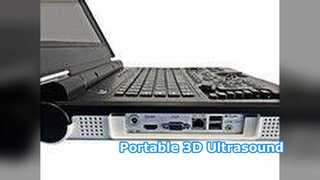 Φορητό Υπερηχογράφημα Ε20 Clinical Hospital