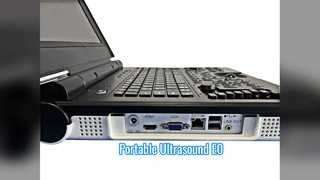 Φορητό Έγχρωμο Doppler Υπερηχογράφημα Ε0 Ουρολογική σάρωση